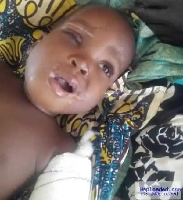 Police arrest wicked stepmothers who tortured and broke 2 year old boy
